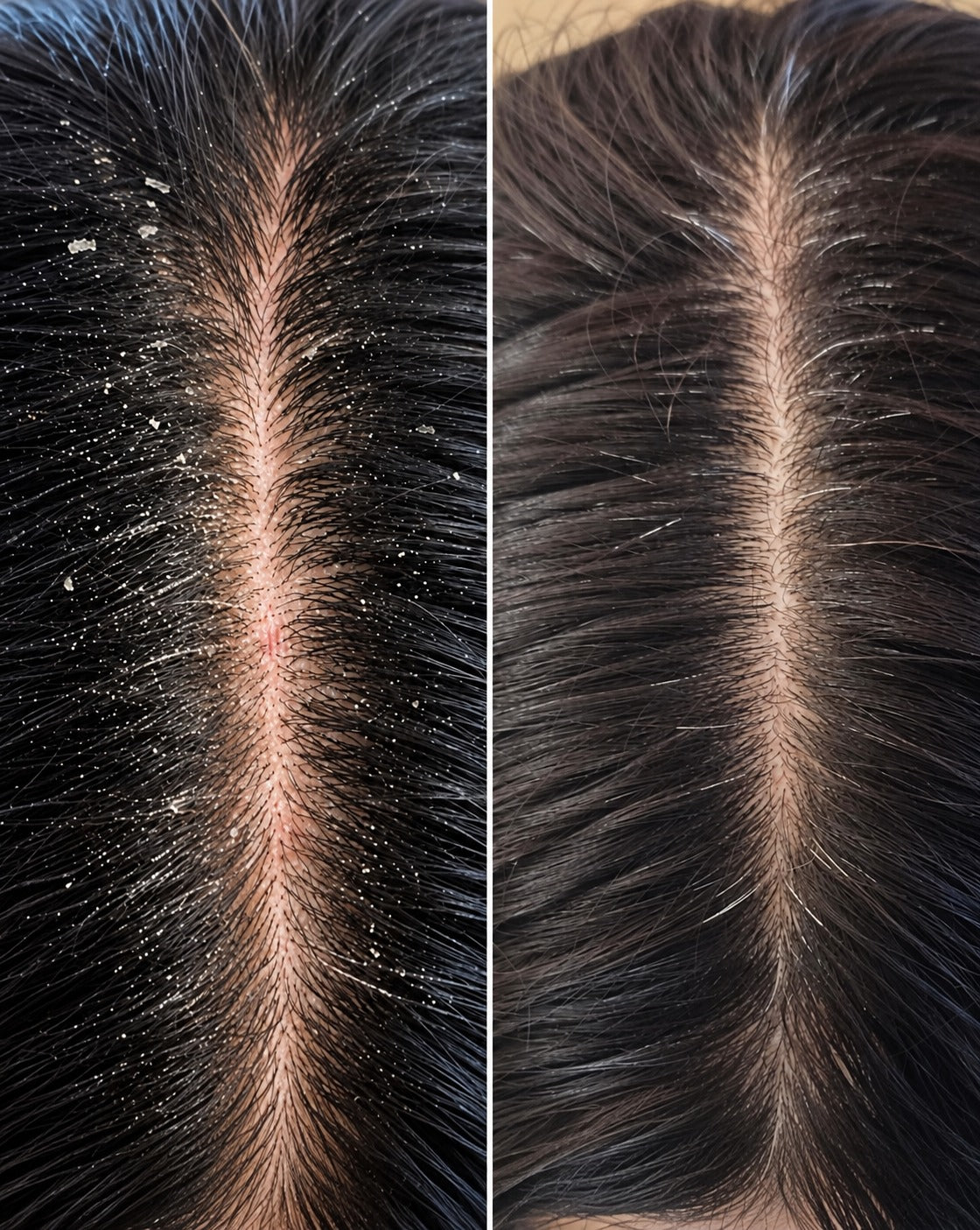 Strongand Dance <br>
Hair Cleanser